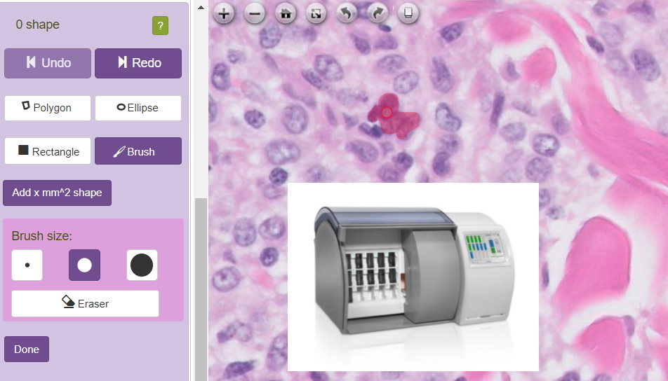 Slide Score displaying a slide from Philips Ultra Fast Scanner Slide Score displaying a slide from Philips Ultra Fast Scanner