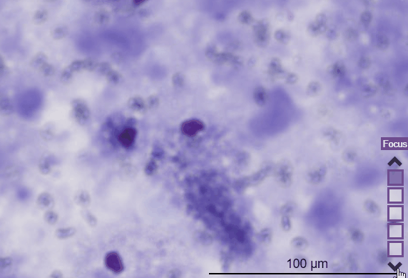 Slide Score displaying a slide with multiple focal planes Slide Score displaying a slide with multiple focal planes